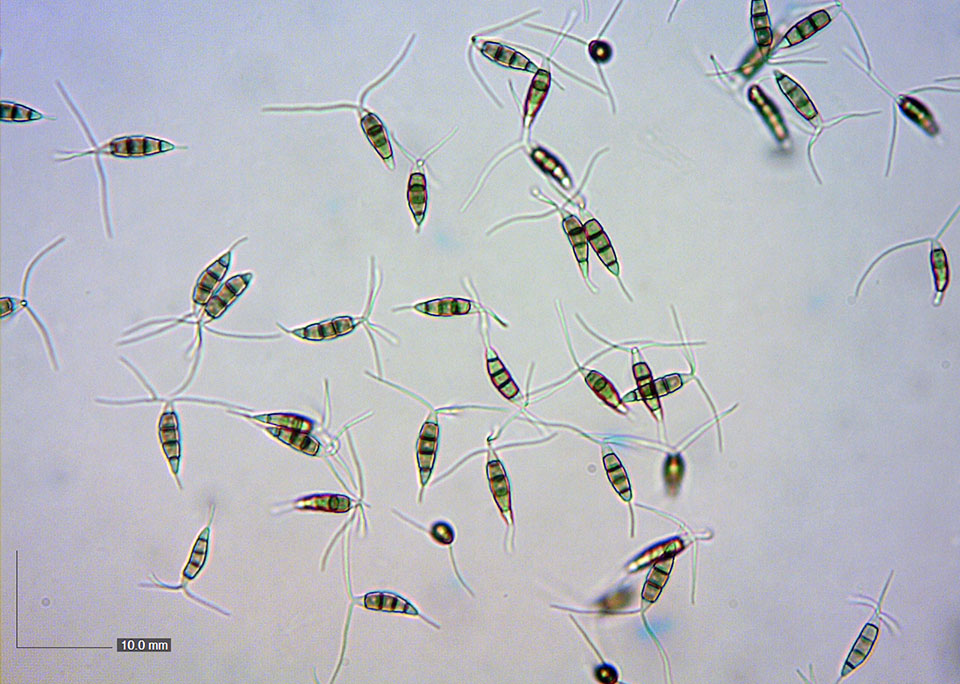 Spores under a microscope.